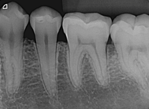 Fonte: https://croimagem.com.br/portfolio-item/radiografia-periapical/